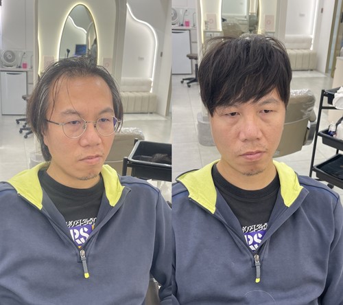 髮量少看到頭皮接髮後怎麼照顧？