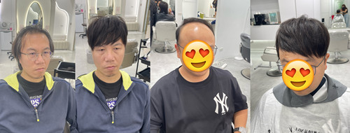 常見頭頂髮量少髮型地雷，這些造型讓您髮量看起來更少