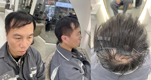 影響男生接髮價格的 5 大因素之一-髮片材質