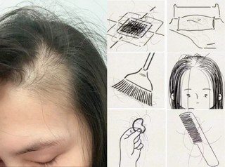 想讓頭髮變多,先了解頭髮為什麼會變少