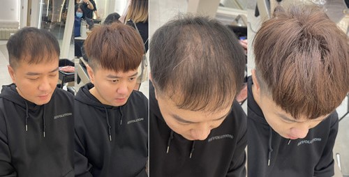接髮推薦案例分享（二）：從不自然到完全看不出痕跡的逆轉案例