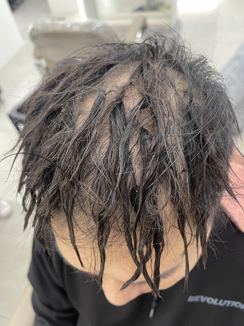 接髮推薦案例分享（二）