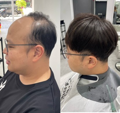 明顯M型禿選擇清爽短髮比刻