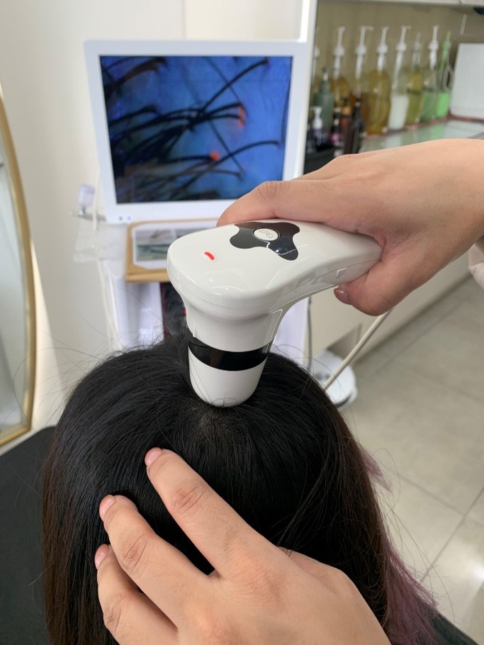 頭皮檢測有助於了解自己的頭皮問題