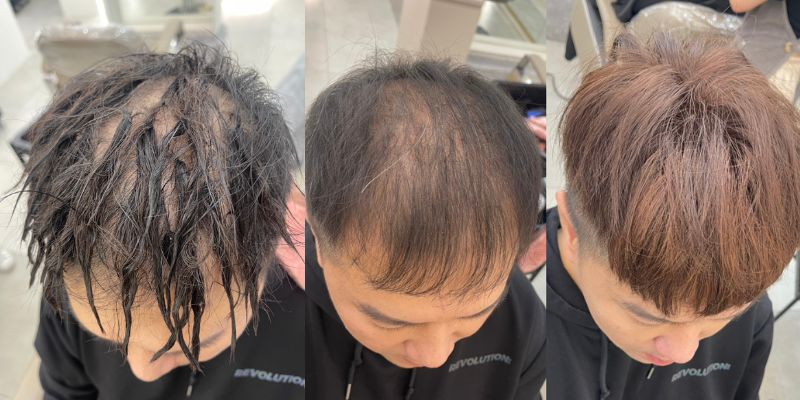 影響男生接髮價格的 5 大因素之一-髮片材質