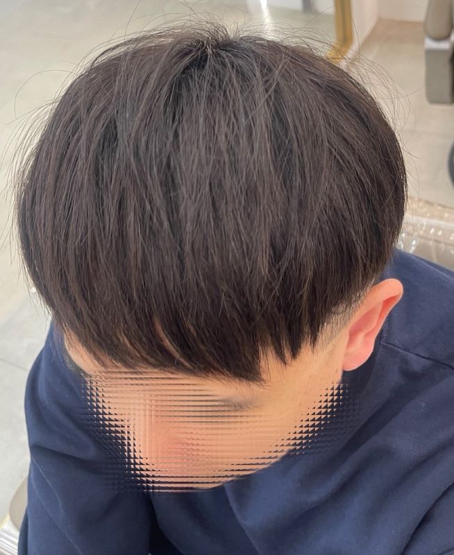 評估適合的髮量密度