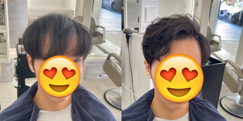 男生接髮方案七：全包覆接髮