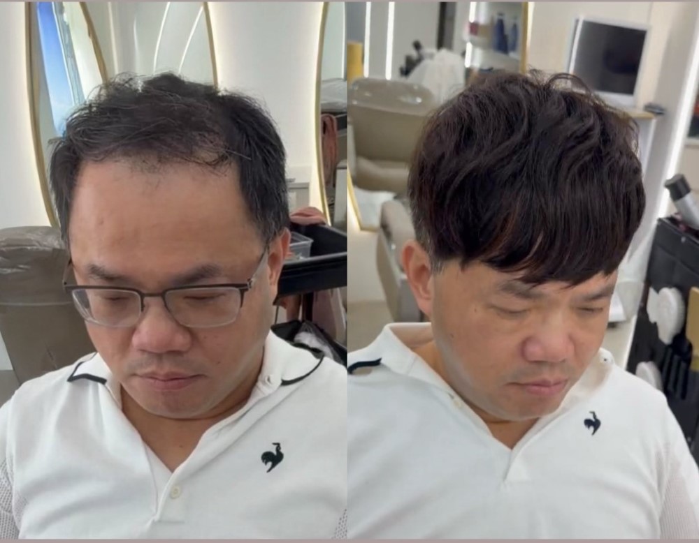 頭頂補髮片看起來自然嗎？