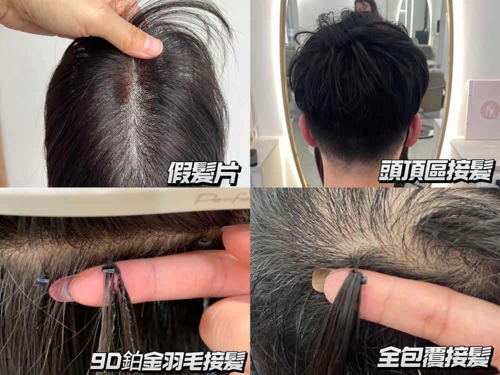 頭頂髮量變少怎麼辦？先看頭頂補髮片、假髮與全包覆接髮哪個適合你