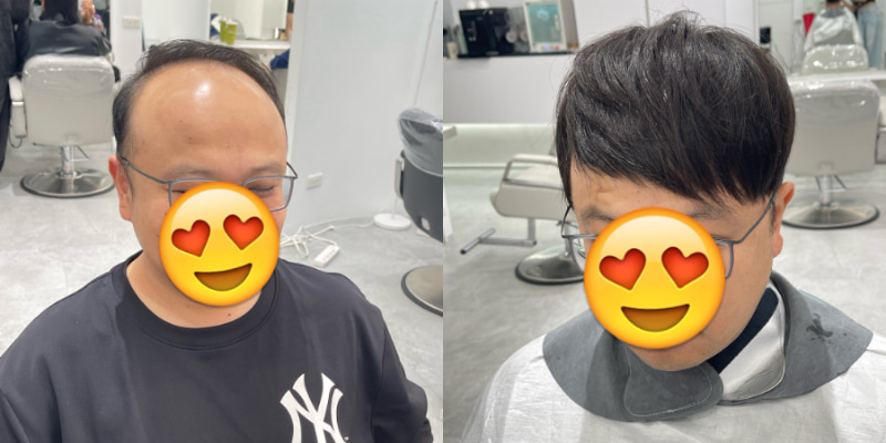 男生接髮方案六：髮克接髮