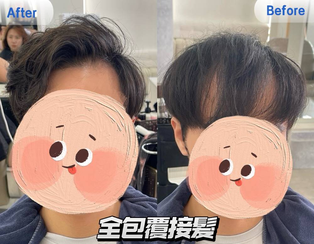 想增加厚度與長度：原生髮量夠可評估9D鉑金羽毛接髮或全包覆接髮