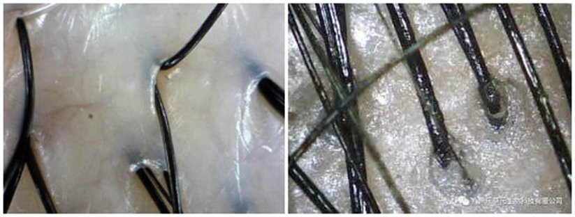 增加髮量方法 2：日常頭皮護理