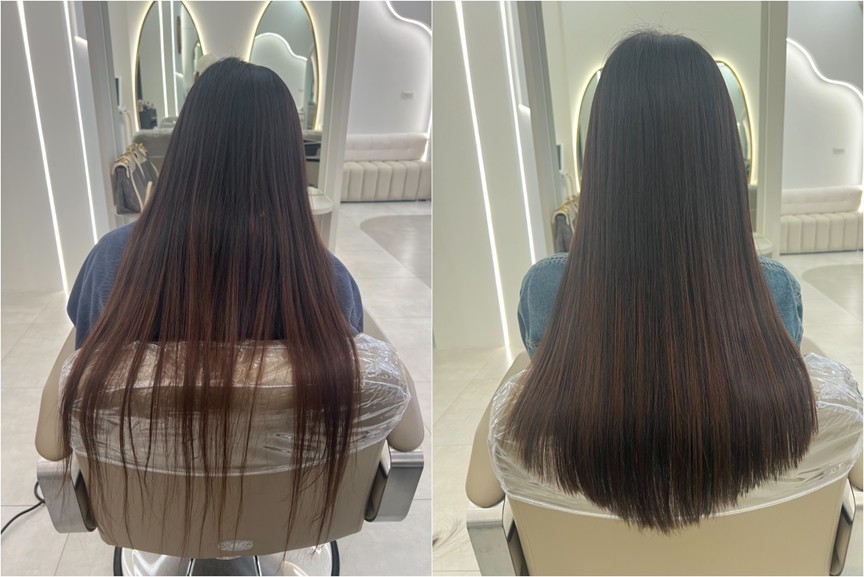 在台中接髮增加髮量案例（一）