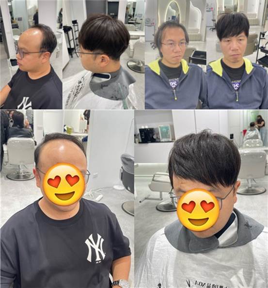 接髮解決男士壓力大掉髮問題