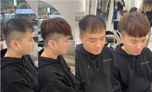 男性接髮前後對比圖