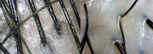 為什麼頭皮要去角質