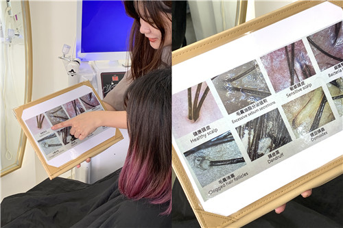 頭皮去角質的好處