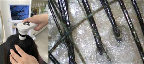 檢測判斷頭皮要不要去角質