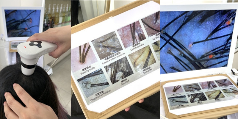 我需要做頭皮去角質嗎？電話亭專業美髮沙龍帶你養護健康頭皮！