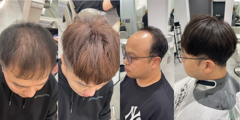 禿頭想做髮型只能戴假髮？了解禿頭適合的髮型與髮量增加技巧