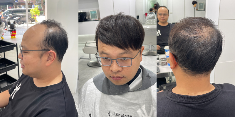 男生接髮｜帶你告別髮量稀疏，重獲濃密髮型 ！