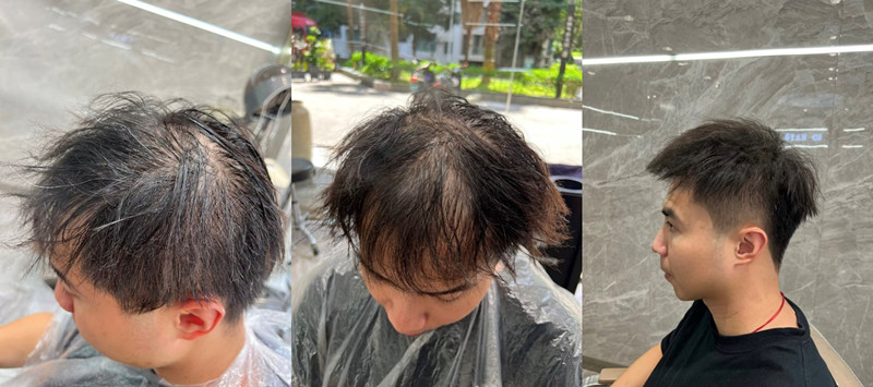 男生接髮|帶你告別髮量稀疏,重獲濃密髮型 ! 男生接髮|帶你告別髮量稀疏,重獲濃密髮型 !