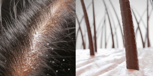 台中頭皮護理推薦 深層清潔養出強韌秀髮