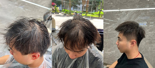 男生接髮｜帶你告別髮量稀疏，重獲濃密髮型 ！