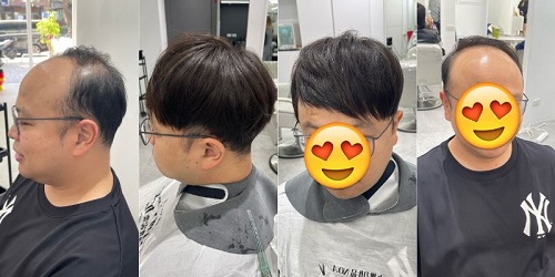 男生接髮價格多少錢？完整價格解析＋維護費用、真實案例分享-500