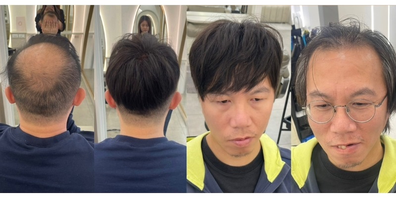 男生假髮怎麼選？種類、自然度、挑選重點與配戴保養完整解析